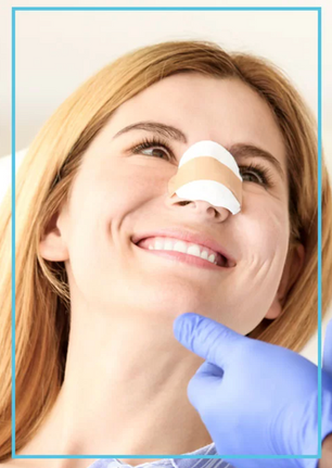 Tips to Speed Up Recovery After Rhinoplasty