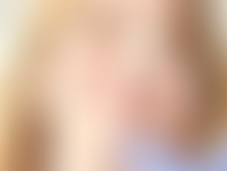Tips to Speed Up Recovery After Rhinoplasty
