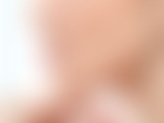 Burun Ameliyatı Sonrası Nasıl Beslenilmeli?