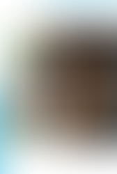 Profiloplasty: What is Profile Aesthetics?
