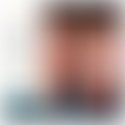 Suleyman Tas Reviews – Rhinoplasty planning and consultation