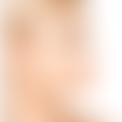 Massage After Rhinoplasty