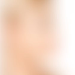 Massage After Rhinoplasty