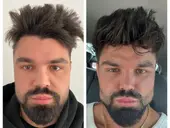 Case Study Number 14 – Celebrity Facial Aesthetics