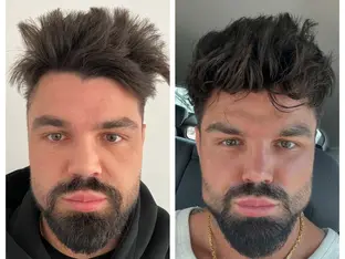 Case Study Number 14 – Celebrity Facial Aesthetics