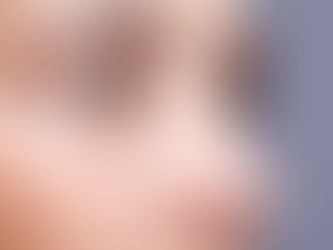 Burun Estetiği Lokal Anesteziyle Mi Yapılır?