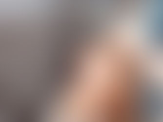 Süleyman Taş Yorumlar Doğal Burun Estetiği 