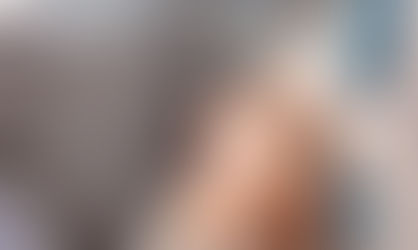 Süleyman Taş Yorumlar Doğal Burun Estetiği