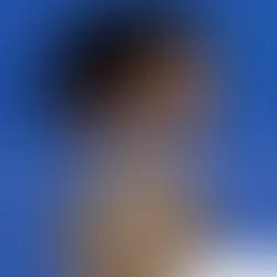 Case Study – Hair Transplant