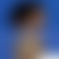Case Study – Hair Transplant