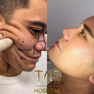 Case Study – Aesthetic facial treatments