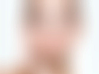 Smoking and Alcohol Consumption After Rhinoplasty
