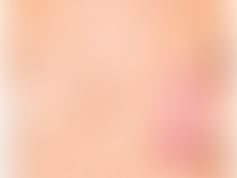 Breast Reconstruction After Breast Cancer