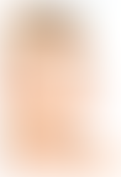 What is the nasal collapse? How can it be addressed?