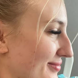 Nefes alamayan kadın, İngiliz cerrahların yardım etmeyi reddetmesinin ardından Türkiye'ye uçtu.