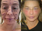 Case Study – Facial Aesthetics