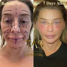 Case Study – Facial Aesthetics