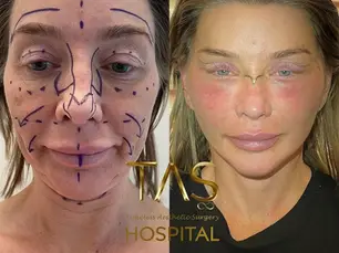 Case Study  – Facial Aesthetics