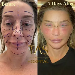 Case Study – Facial Aesthetics