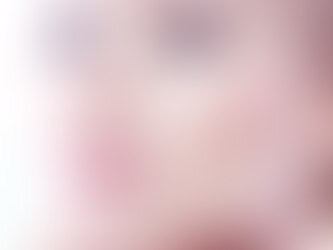 How are nostrils and wings reduction surgeries performed?