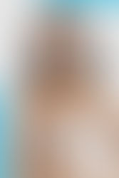 Pregnancy and Breast Aesthetic Surgeries