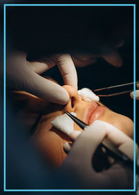 Expert Recommendations For The Best Rhinoplasty Experience