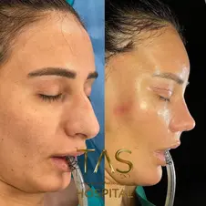 Case Study – Youthful facial appearance