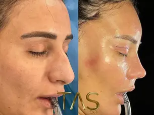 Case Study – Youthful facial appearance