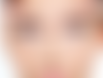 Best Non-Surgical Wrinkle Treatments