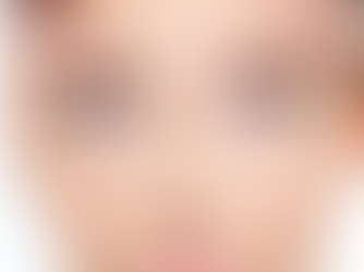 Best Non-Surgical Wrinkle Treatments