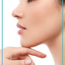When can I start exercising after rhinoplasty?
