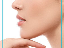 When can I start exercising after rhinoplasty?
