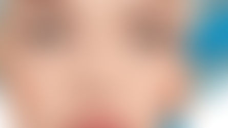 Göz Kapağı Estetiği Nedir?