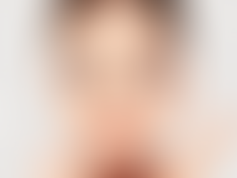 Bursa Dolgu – Op. Dr. Ömer BUHŞEM ile Dolgu Uygulamaları Hakkında Bilgilendirme