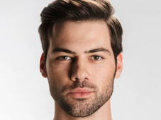 Male Rhinoplasty