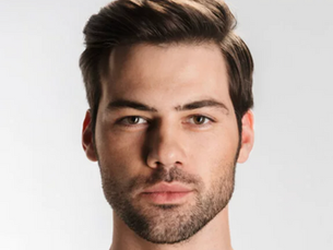 Male Rhinoplasty