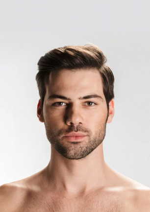 Male Rhinoplasty