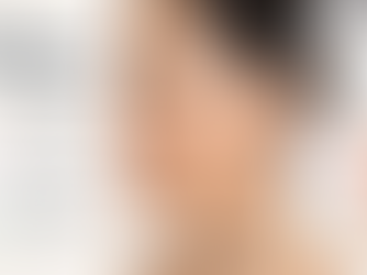 best treatments for melasma and skin rejuvenation - Amber Skin Clinics