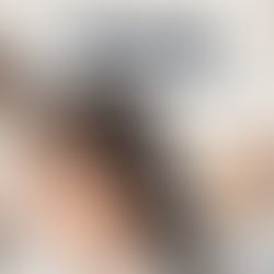 alternatives to minoxidil shedding for hair loss - Amber Skin Clinics