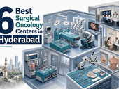 6 Best Surgical Oncology Centers in Hyderabad