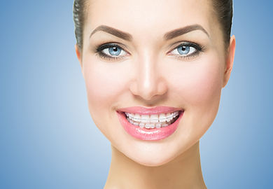 Healthy smiling adult wearing ceramic braces