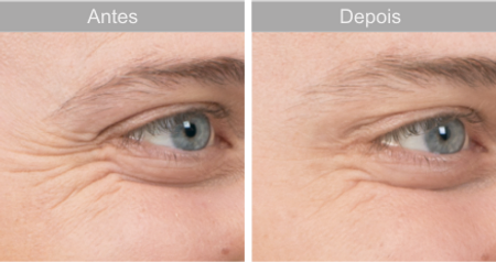 Colageno Hidrlisado Collagen Care