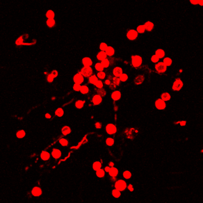 Did you know that the Borrelia bacterium can change its shape?