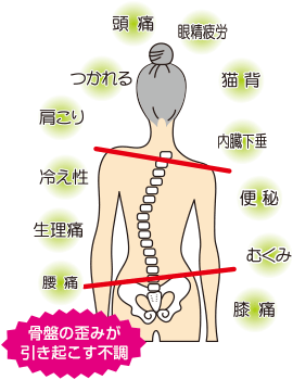 treat_chosei_ill_fucho[1]-thumb-270x350-2539.gif
