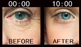 縮圖：Plexaderm Rapid Reduction Cream PLUS 微整型極速減眼袋眼紋霜5ML