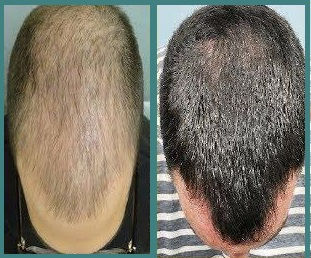 縮圖：MADARA - 3 MIN GROWTH-BOOST SCALP TREATMENT 3分鐘真菌激活髮絲生長 -治療頭皮素 100ml
