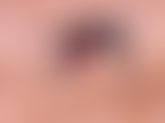 Hasta la fecha se han presentado 1432 casos de Dengue en el Atlántico