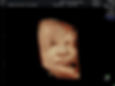 3D ultrasound service