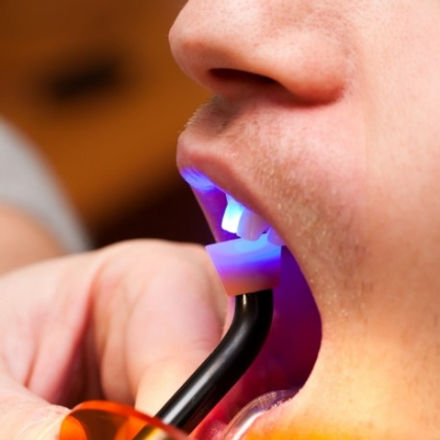 Cosmetic Dentistry