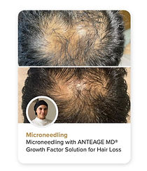 Male aesthetic treatment before and after